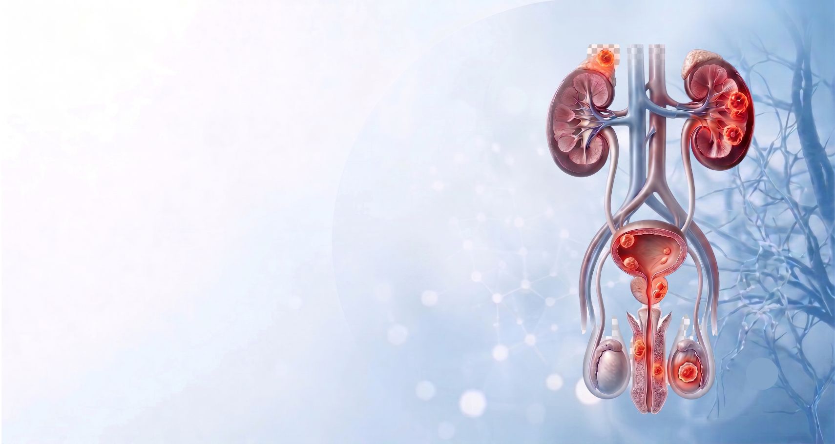 Prostate Cancer Treatment & Robotic Surgery Banner
